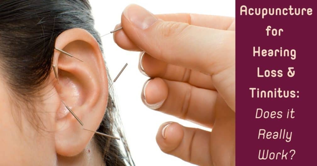 sydney-auricular-acupuncture-therapy-marquee-health-clinic